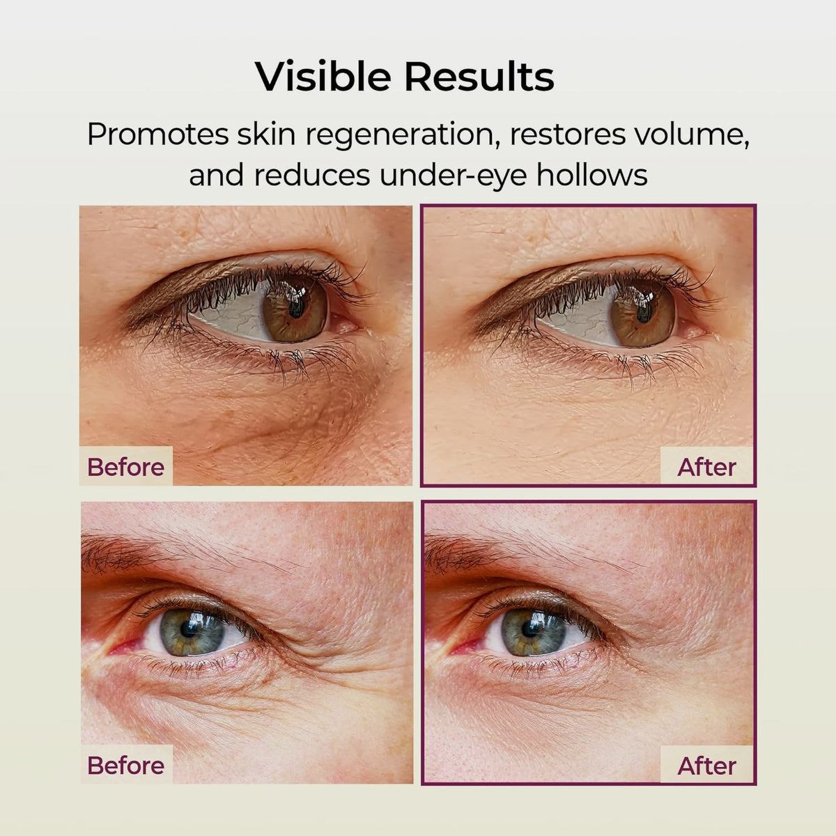 Visible results card with before and after under-eye close-ups